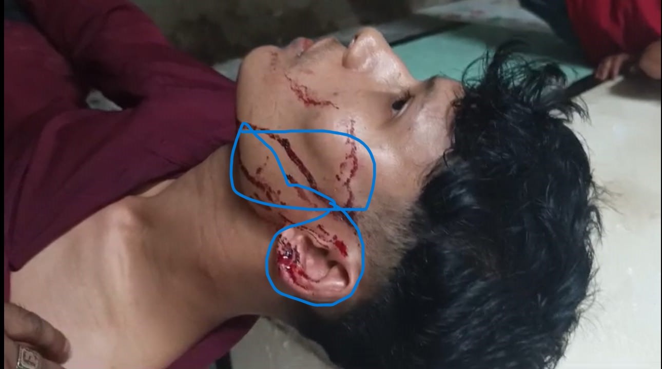 ভ্যান সরানো নিয়ে কথা-কাটাকাটি, পরে যুবককে কুপিয়ে জখমের ঘটনায় থানায় লিখিত অভিযোগ